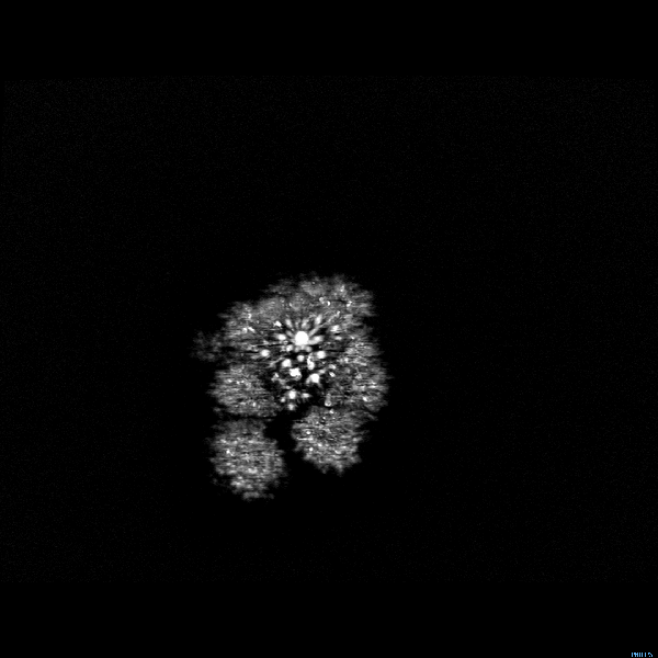 MRI+scan+of+broccoli