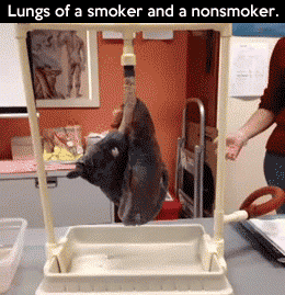Lungs+of+a+smoker.