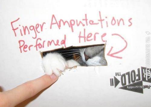 Finger+Amputations
