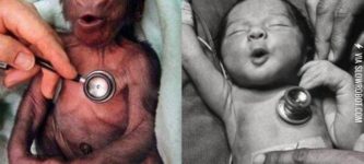 Baby+gorilla+%26amp%3B+baby+human+reacting+to+a+cold+stethoscope.