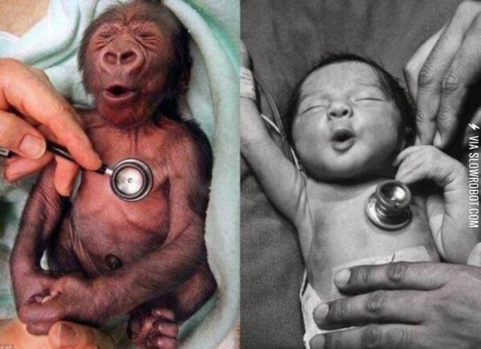 Baby+gorilla+%26amp%3B+baby+human+reacting+to+a+cold+stethoscope.