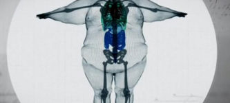 An+X-Ray+Of+A+900+Pound+Man