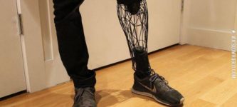 3D+printed+prosthesis