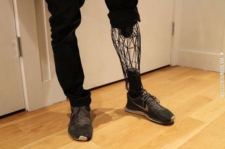 3D+printed+prosthesis