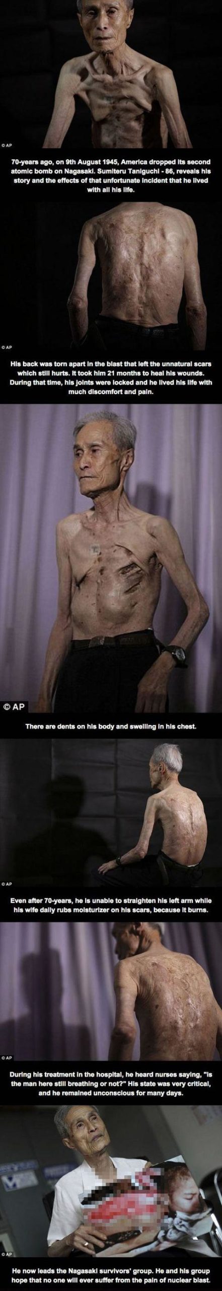 He+Was+16+When+The+Nuclear+Bombs+Exploded+in+Japan