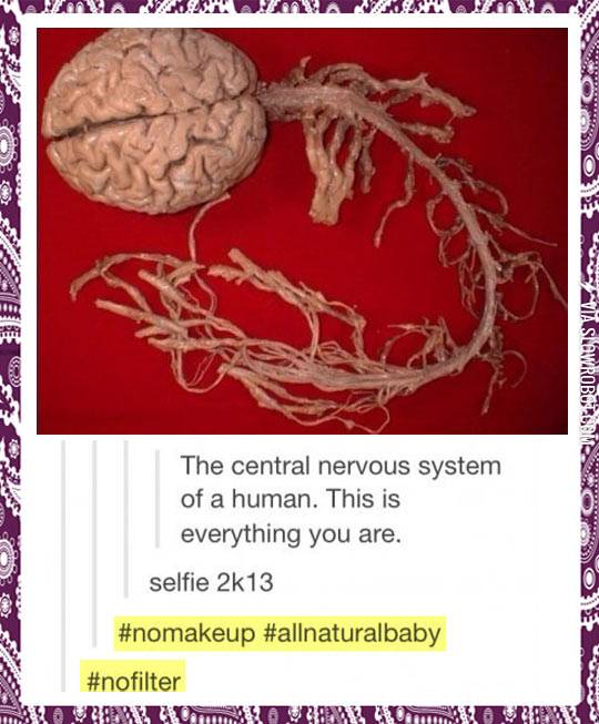 The+central+nervous+system+of+a+human.