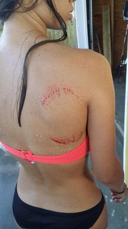 Just+a+little+sharkbite