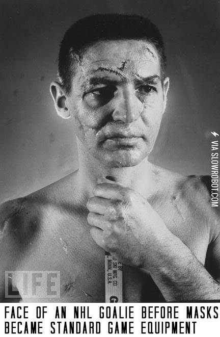 Face+of+an+NHL+goalie+before+masks+became+standard+game+equipment