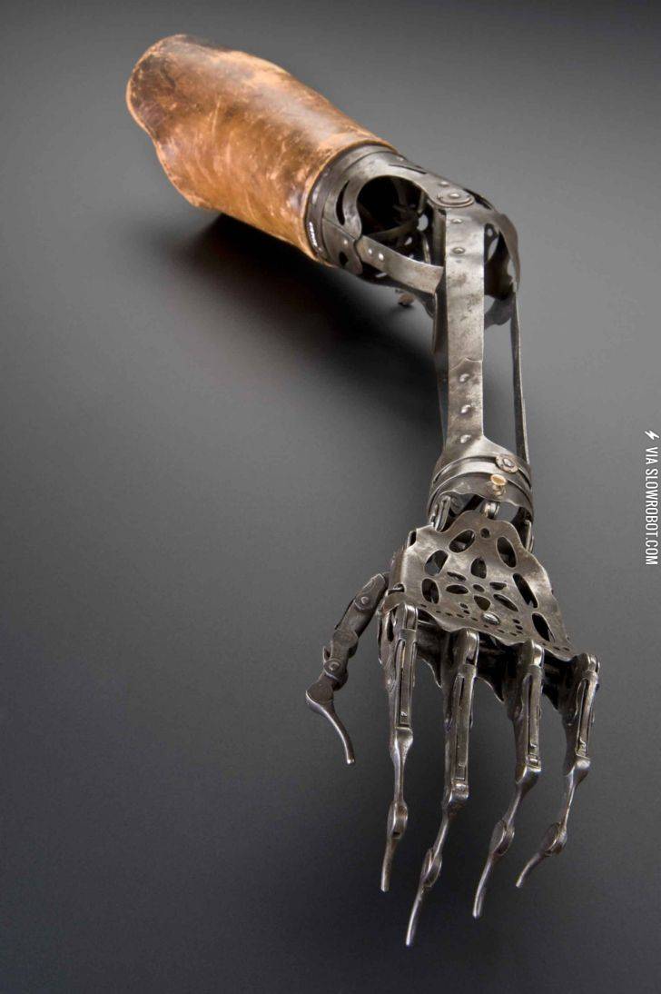 150+Year+Old+Victorian+Prosthetic+Hand.