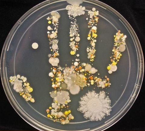 A+microbiological+culture+of+an+8-Year+old%26%23039%3Bs+handprint+after+playing+outside