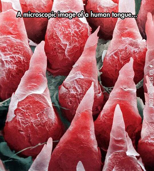 This+is+what+your+tongue+looks+like.