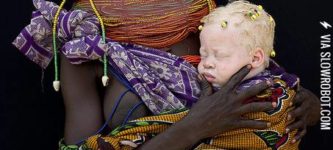 African+tribeswoman+with+her+albino+baby