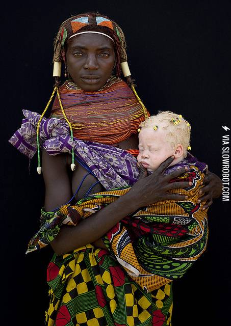 African+tribeswoman+with+her+albino+baby