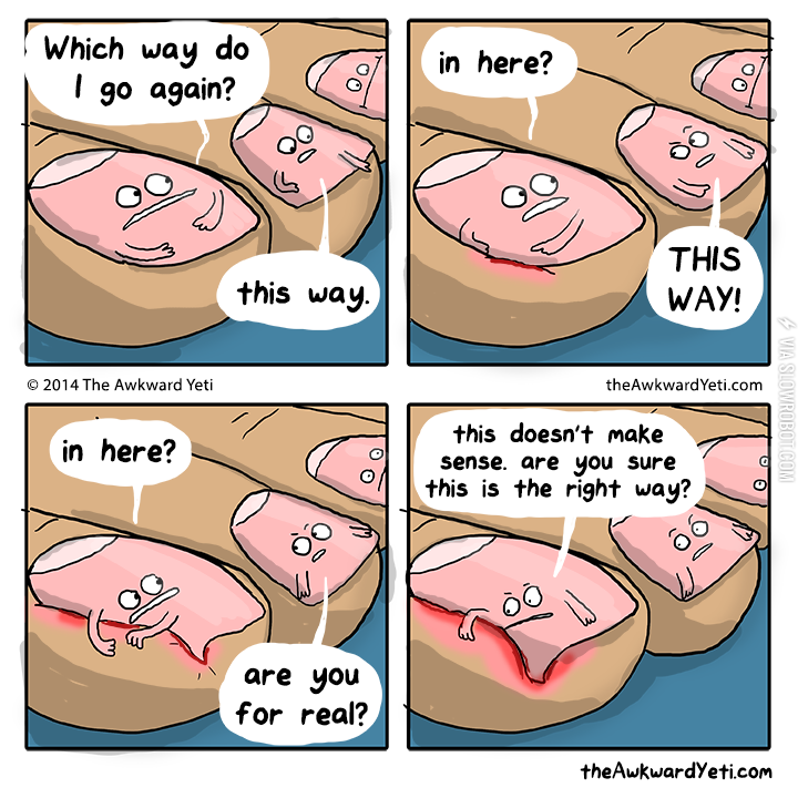 Ingrown+toenails.