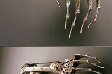 Victorian+Artificial+Arm+From+The+1800s