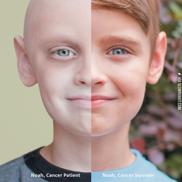 Patient+vs.+survivor