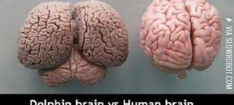 Dolphin+brain+vs+Human+brain