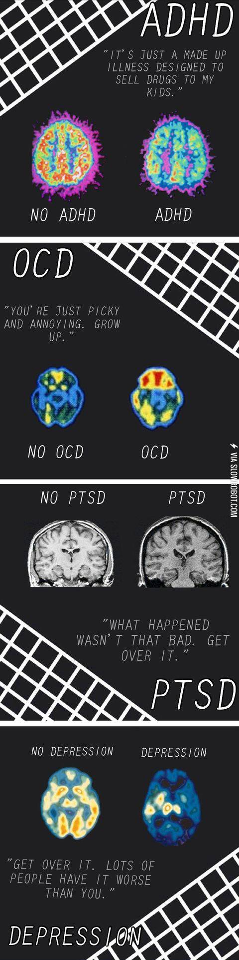 Brains+with+mental+disorders.