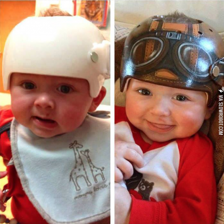 An+artist+is+doing+a+really+cool+thing+by+painting+baby%26%238217%3Bs+medical+helmets