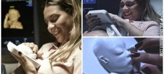 3D+printed+ultrasound+for+blind+expectant+mother