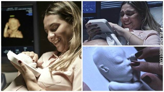 3D+printed+ultrasound+for+blind+expectant+mother