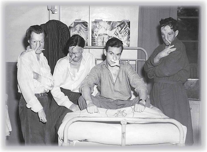 The+Guinea+Pig+Club%2C+established+in+1941%2C+for+British+and+allied+aircrew+who+had+undergone+experimental+reconstructive+plastic+surgery+after+receiving+burns+injuries+in+aircraft+during+World+War+II