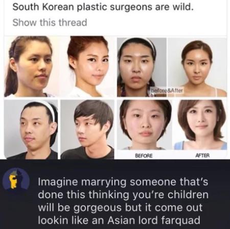 South+Korean+Plastic+Surgeons+Are+Wild