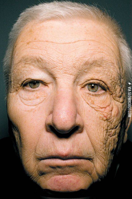 The+result+of+driving+a+truck+for+28+years+exposing+only+half+of+your+face+to+direct+sunlight.