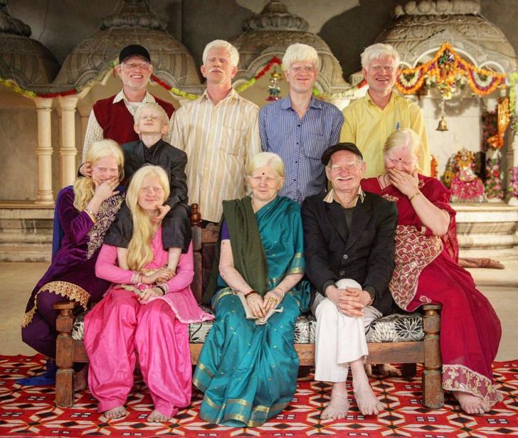 Three+generations+of+an+Indian+family+with+albinism+pose+for+a+photograph