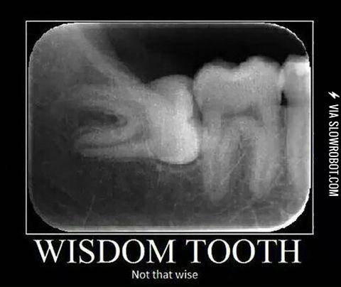 Why+do+wisdom+tooth+even+exist%3F
