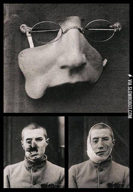 A+prosthetic+face+plate+from+WWI