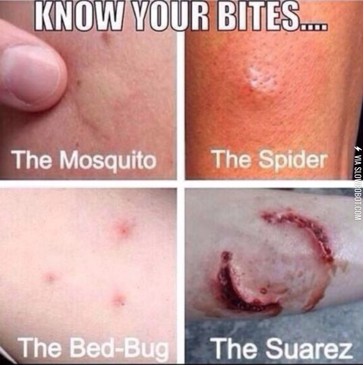 Know+your+bites%21