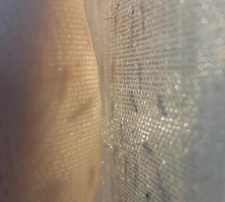 Mosquitoes+trying+to+reach+skin+through+net