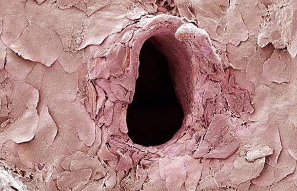 What+happens+when+a+needle+pierces+your+skin..