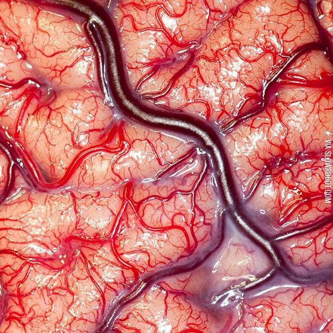 Close-up+photo+of+a+living+human+brain.
