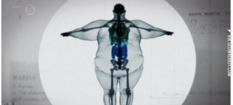 X-ray+of+a+900+pound+man.