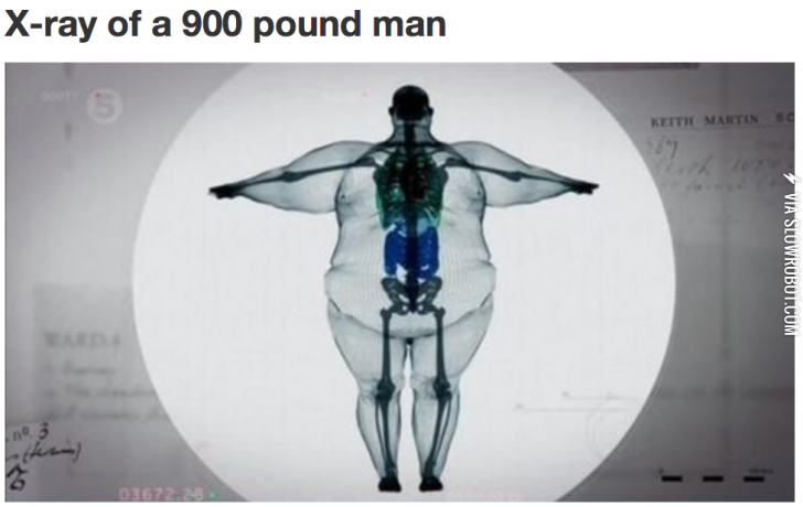 X-ray+of+a+900+pound+man.