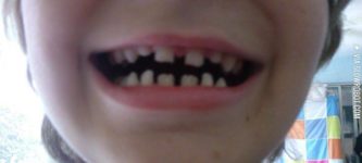 My+nephew+has+the+batman+symbol+in+the+gaps+of+his+teeth