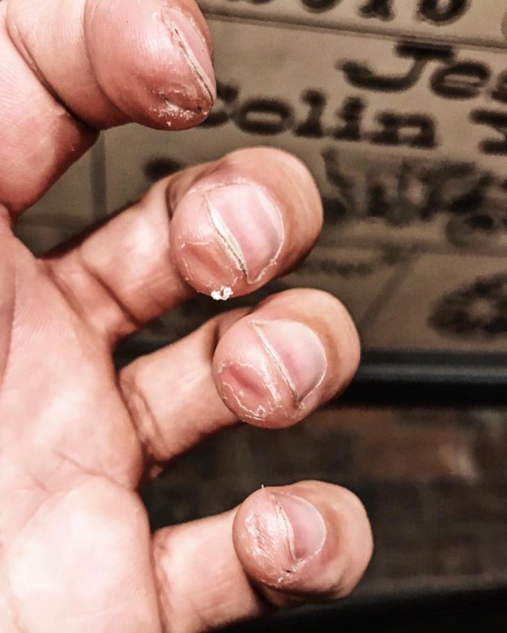 A+professional+guitarist%26%238217%3Bs+fingers+at+the+end+of+a+tour