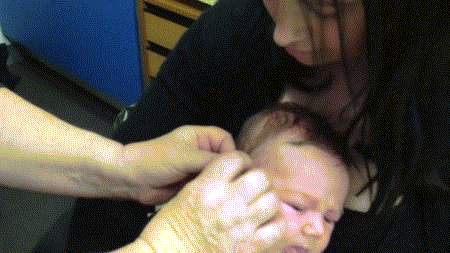 7+week+old+boy+has+hearing+aids+on+for+the+first+time