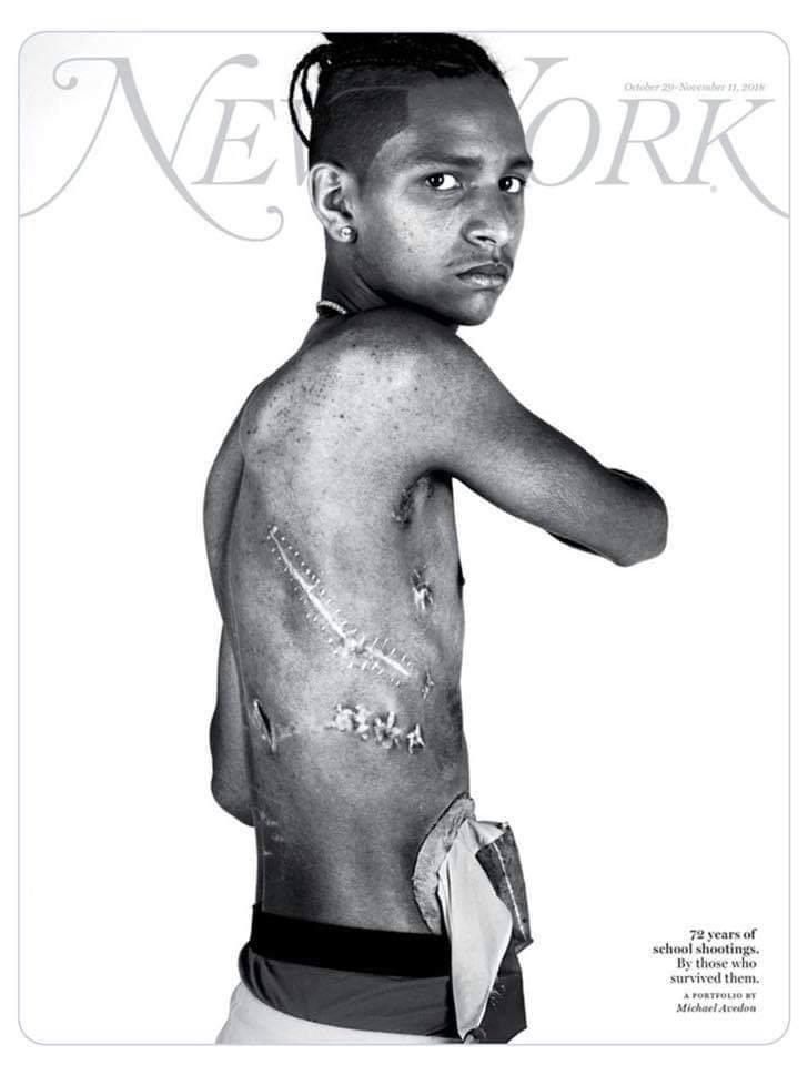 Meet+Anthony+Borges%2C+whom+saved+the+lives+of+20+of+his+Parkland+classmates+by+using+his+body+to+keep+the+shooter+from+coming+in+the+room.+He+was+shot+five+times.