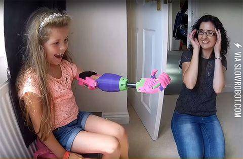 3D+printed+Prosthetic+Arm+designed+and+hand-delivered+by+Stephen+Davies%2C+to+an+8+Year+old