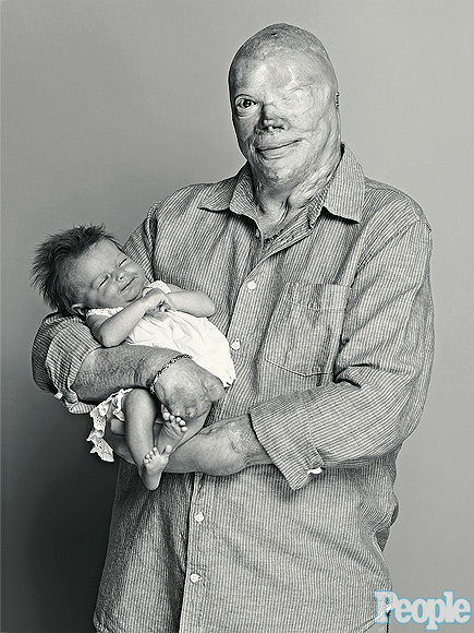 Joe+Kinan+was+horribly+burned+in+the+2003+Station+nightclub+fire%2C+which+killed+his+girlfriend+Karla+and+99+other+people.+Here+he+is+in+2014%2C+smiling+with+his+newborn+daughter%2C+Hadley.