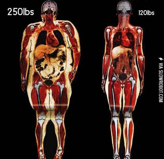 Body+scans.+Fat+vs.+thin.
