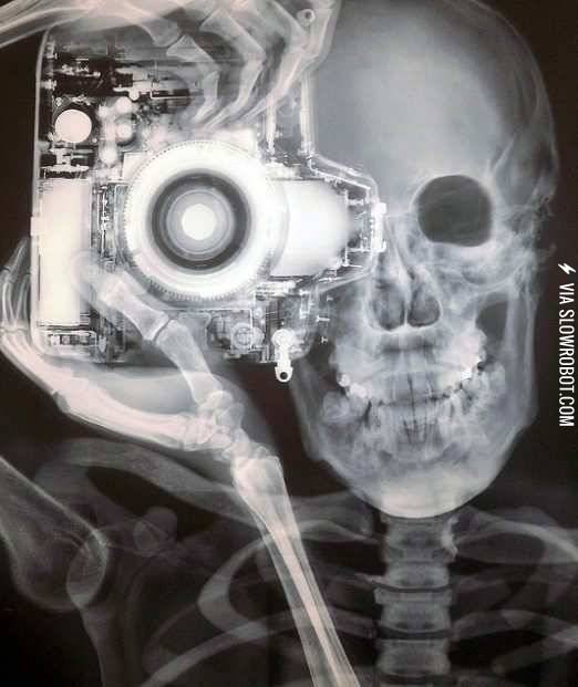 X-Ray+self+portrait.
