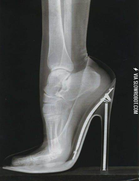 This+is+why+high+heels+hurt+your+feet.