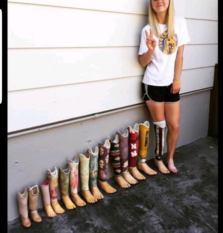 Prosthetic+leg+progression