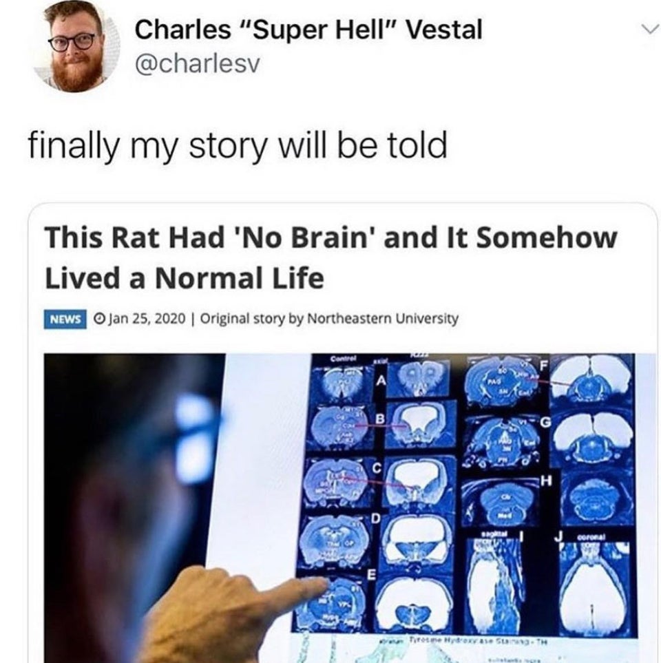 the+story+of+the+rat+that+survived+with+no+brain