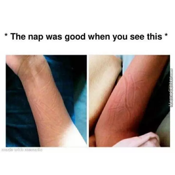 nothing+like+the+blanket+skin+wrinkles